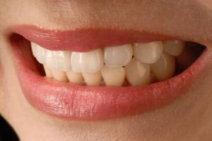 Удаление импланта зуба: можно ли?